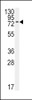 Western blot analysis of anti-BMPR1A Antibody (N-term K36) in 293 cell line lysates (35ug/lane) .