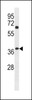 Western blot analysis in NCI-H460 cell line lysates (35ug/lane) .