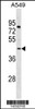 Western blot analysis in MDA-MB453 cell line lysates (35ug/lane) .