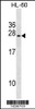 Western blot analysis in HL-60 cell line lysates (35ug/lane) .