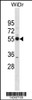 Western blot analysis in WiDr cell line lysates (35ug/lane) .