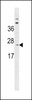 Western blot analysis in MDA-MB231 cell line lysates (35ug/lane) .