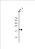 Western Blot at 1:1000 dilution + MCF-7 whole cell lysate Lysates/proteins at 20 ug per lane.