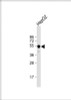 Western Blot at 1:1000 dilution + HepG2 whole cell lysate Lysates/proteins at 20 ug per lane.