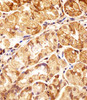Immunohistochemical analysis of paraffin-embedded H. stomach section using POLDIP3 Antibody (N-term) . Antibody was diluted at 1:25 dilution. A undiluted biotinylated goat polyvalent antibody was used as the secondary, followed by DAB staining.