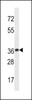 Western blot analysis in mouse brain tissue lysates (35ug/lane) .