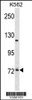 Western blot analysis in K562 cell line lysates (35ug/lane) .