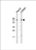 Western Blot at 1:1000 dilution Lane 1: HepG2 whole cell lysate Lane 2: U266B1 whole cell lysate Lysates/proteins at 20 ug per lane.