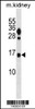 Western blot analysis in mouse kidney tissue lysates (35ug/lane) .