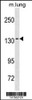 Western blot analysis in mouse lung tissue lysates (35ug/lane) .