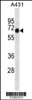 Western blot analysis in A431 cell line lysates (35ug/lane) .