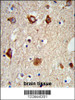 Formalin-fixed and paraffin-embedded mouse brain tissue reacted with MAP2 Antibody, which was peroxidase-conjugated to the secondary antibody, followed by DAB staining.