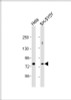 Western Blot at 1:1000 dilution Lane 1: Hela whole cell lysate Lane 2: SH-SY5Y whole cell lysate Lysates/proteins at 20 ug per lane.