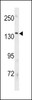 Western blot analysis in MDA-MB453 cell line lysates (35ug/lane) .