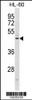 Western blot analysis in HL-60 cell line lysates (35ug/lane) .