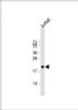 Western Blot at 1:1000 dilution + Jurkat whole cell lysate Lysates/proteins at 20 ug per lane.