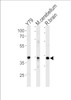 Western blot analysis in Y79 cell line, mouse cerebellum and rat brain tissue lysates (35ug/lane) .