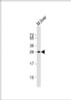 Western Blot at 1:1000 dilution + mouse liver lysate Lysates/proteins at 20 ug per lane.