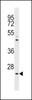 Antibody is used in Western blot to detect NeuroG1 in A375 cell lysate.