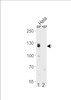 Western blot analysis of CUL4B Antibody Pab pre-incubated without (lane 1) and with (lane 2) blocking peptide in Hela cell line lysate.