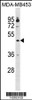 Western blot analysis in MDA-MB453 cell line lysates (35ug/lane) .