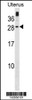 Western blot analysis in human Uterus tissue lysates (35ug/lane) .