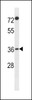 Western blot analysis in A2058 cell line lysates (35ug/lane) .