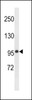 Western blot analysis in mouse bladder tissue lysates (35ug/lane) .