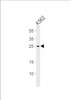 Western blot analysis of lysate from K562 cell line, using RAB27A Antibody at 1:1000.