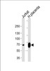 Western blot analysis of lysates from Jurkat cell line and human placenta tissue lysate (from left to right) , using LIMK2 Antibody at 1:1000 at each lane.