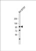 Western Blot at 1:1000 dilution + SH-SY5Y whole cell lysate Lysates/proteins at 20 ug per lane.