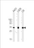 Western blot analysis in A431, mouse L929, rat C6 cell line lysates (35ug/lane) .This demonstrates the CCND1 antibody detected the CCND1 protein (arrow) .