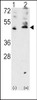 Western blot analysis of VEGF3 Antibody polyclonal antibody using 293 cell lysates (2 ug/lane) either nontransfected (Lane 1) or transiently transfected with the VEGF3 gene (Lane 2) .