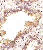 Immunohistochemical analysis of paraffin-embedded H. prostate section using ZRSR2 Antibody . Antibody was diluted at 1:25 dilution. A undiluted biotinylated goat polyvalent antibody was used as the secondary, followed by DAB staining.