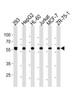 Western blot analysis in 293, HepG2, HL-60, Jurkat, MCF-7, ZR-75-1 cell line lysates (35ug/lane) .