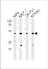 Western blot analysis in Hela, MCF-7, ZR-75-1 cell line and mouse brain lysates (35ug/lane) .