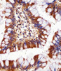 Immunohistochemical analysis of paraffin-embedded H. colon section using PRS4 Antibody . Antibody was diluted at 1:25 dilution. A undiluted biotinylated goat polyvalent antibody was used as the secondary, followed by DAB staining.