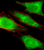 Fluorescent image of Hela cells stained with PRS4 Antibody . Antibody was diluted at 1:25 dilution. An Alexa Fluor 488-conjugated goat anti-rabbit lgG at 1:400 dilution was used as the secondary antibody (green) . Cytoplasmic actin was counterstained with Alexa Fluor 555 conjugated with Phalloidin (red) .