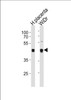 Western blot analysis in WiDr cell line and human placenta tissue lysates (35ug/lane) .