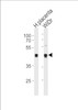 Western blot analysis in WiDr cell line and human placenta tissue lysates (35ug/lane) .