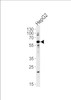 Western blot analysis in HepG2 cell line lysates (35ug/lane) . This demonstrates that the ZNF192 antibody detected the ZNF192 protein (arrow) .