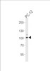 Western blot analysis of lysate from PC-12 cell line, using Rat Atp1a1 Antibody (S23) at 1:1000 at each lane