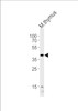 Western blot analysis of lysate from mouse thymus tissue lysate, using Mouse Tfap2a Antibody at 1:1000 at each lane.