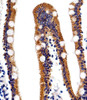 Immunohistochemical analysis of paraffin-embedded H.small intestine section using ACVRL1 Antibody (N-term) . Antibody was diluted at 1:25 dilution. A peroxidase-conjugated goat anti-rabbit IgG at 1:400 dilution was used as the secondary antibody, followed by DAB staining.