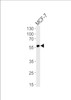 Western blot analysis of lysate from MCF-7 cell line, using ACVRL1 Antibody at 1:1000.