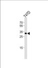 Western blot analysis of lysate from T47D cell line, using ING4 Antibody at 1:1000.