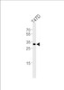 Western blot analysis of lysate from T47D cell line, using ING4 Antibody at 1:1000.