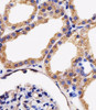 Immunohistochemical analysis of paraffin-embedded H.kidney section using AK4 Antibody . Antibody was diluted at 1:25 dilution. A peroxidase-conjugated goat anti-rabbit IgG at 1:400 dilution was used as the secondary antibody, followed by DAB staining.