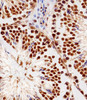 Immunohistochemical analysis of paraffin-embedded M. testis section using RBX1 Antibody . Antibody was diluted at 1:100 dilution. A peroxidase-conjugated goat anti-rabbit IgG at 1:400 dilution was used as the secondary antibody, followed by DAB staining.