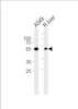 Western blot analysis of lysates from A549 cell line and rat liver tissue lysate (from left to right) , using ALDH1A1 Antibody at 1:1000 at each lane.